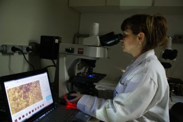 Células bacterianas com polímero intracelular (biodegradável ), observação por microscopia de fluorescência