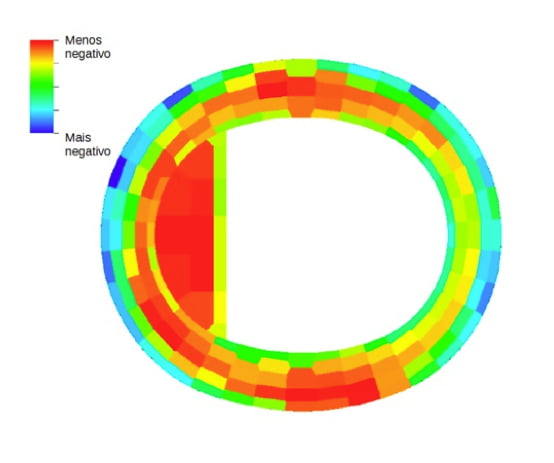 Piores casos de ∆C_P para situações de sucção
