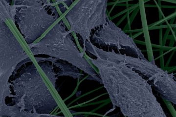 Microscopia Eletrônica de Varredura mostra fibroblastos de camundongos em arcabouço de nanofibras de PLGA esterilizado por ozônio