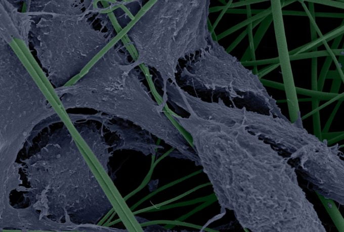 Microscopia Eletrônica de Varredura mostra fibroblastos de camundongos em arcabouço de nanofibras de PLGA esterilizado por ozônio