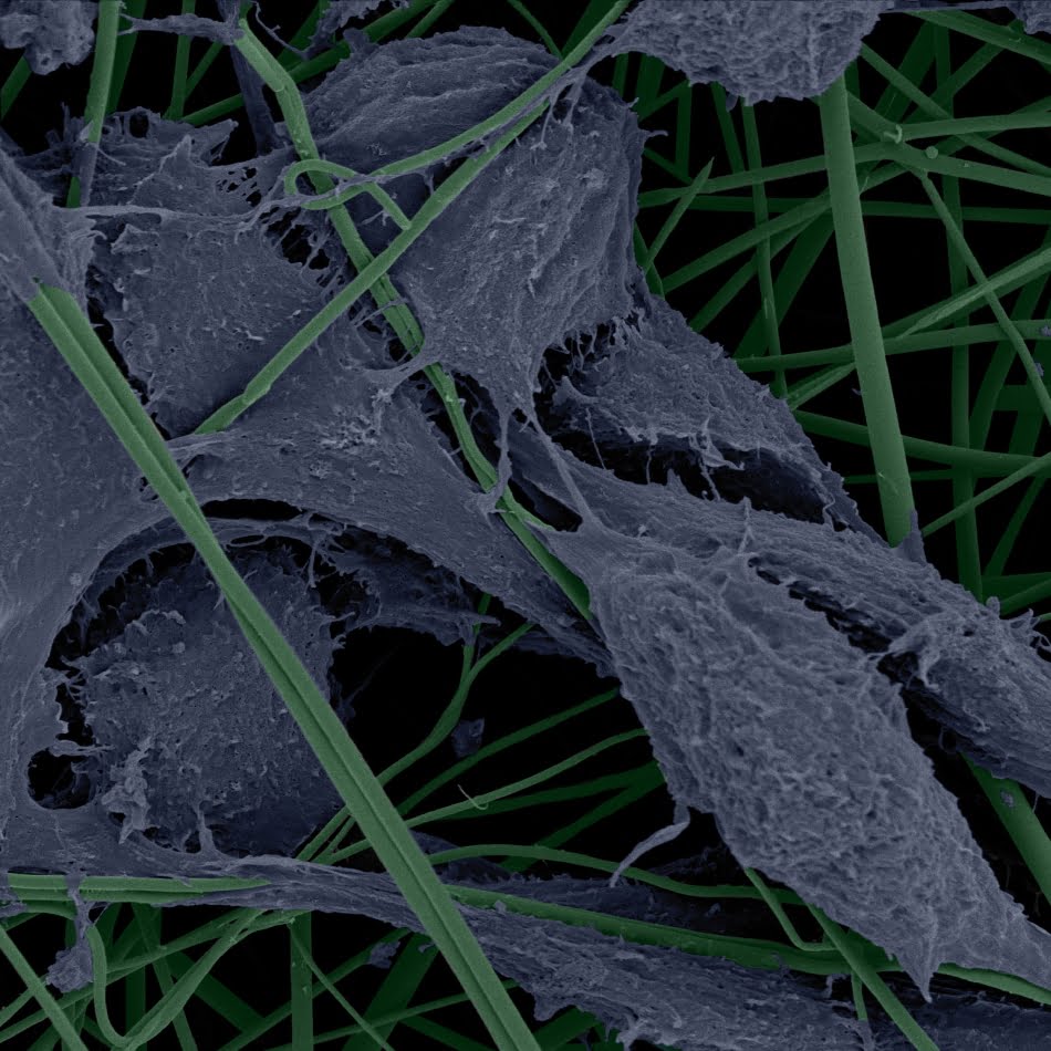 Microscopia Eletrônica de Varredura mostra fibroblastos de camundongos em arcabouço de nanofibras de PLGA esterilizado por ozônio