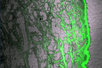 Fotomicrografia (aumento de 10 vezes) da imagem da permeação do nanocarreador polimérico de gelatina contendo nanopartículas de extrato de Centella Asiatica na camada interna da pele