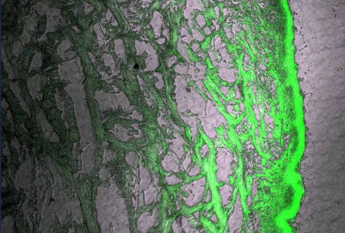 Fotomicrografia (aumento de 10 vezes) da imagem da permeação do nanocarreador polimérico de gelatina contendo nanopartículas de extrato de Centella Asiatica na camada interna da pele