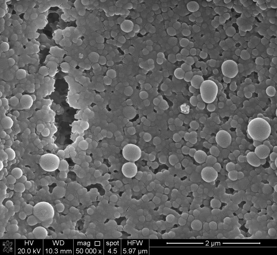 Combate à leishmaniose 2 Imagem de microscopia eletrônica dos nanocarreadores poliméricos coloidais de maltodextrina contendo antimoniato de meglumina