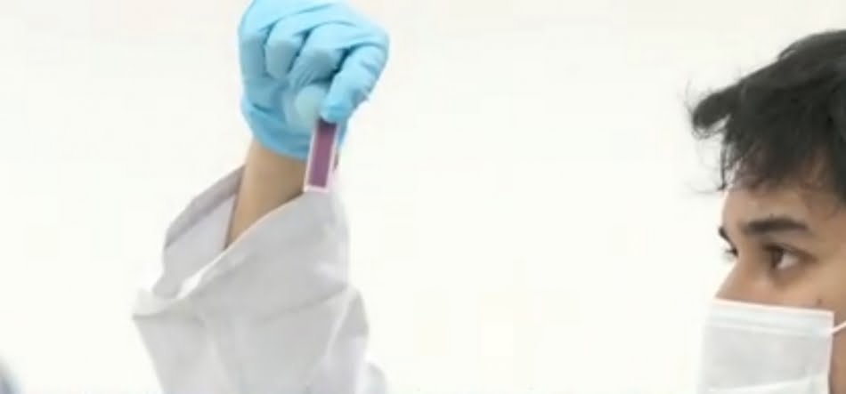 Possibilidade de realizar testes sem necessidade de equipamentos laboratoriais ou deslocamento até postos de atendimento público e de exames é apontada como ponto forte do projeto