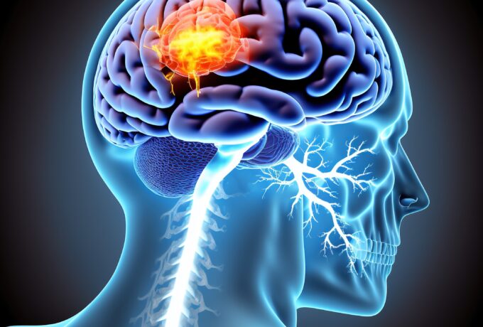 Tumor de cabeca ilustra