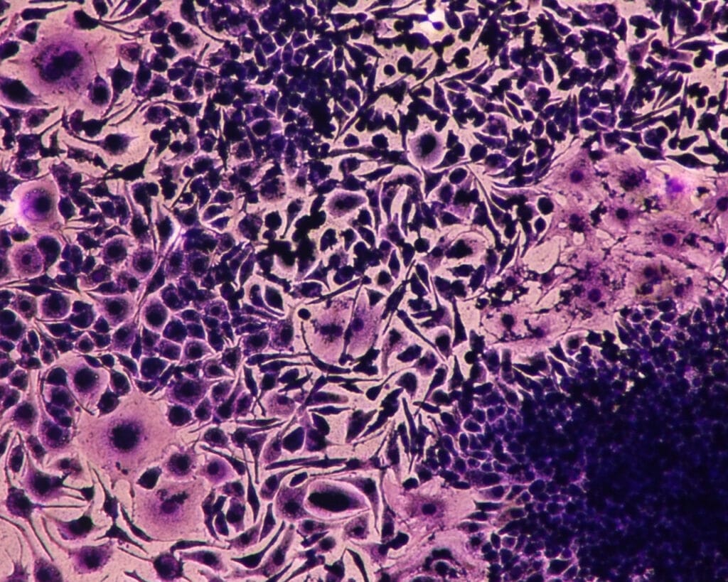 Terapia gênica contra a psoríase 2 Captured 10X z1