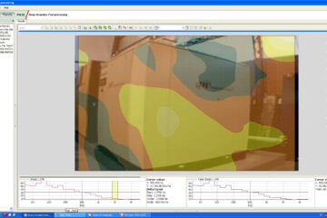 holografia acustica medicao 3
